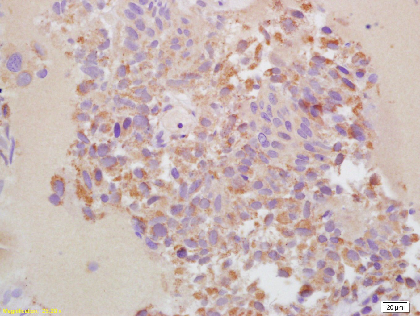 Anti-MMP-13 Polyclonal Antibody