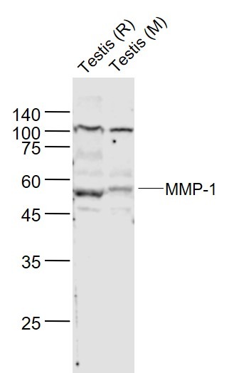 Anti-MMP-1 Polyclonal Antibody 2