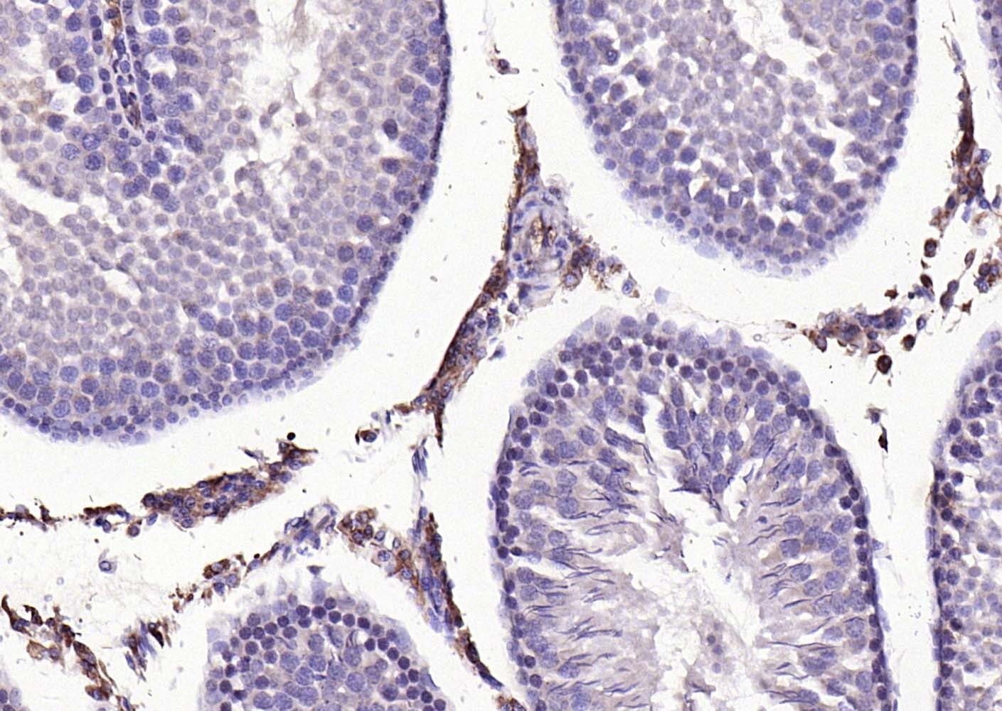 Anti-MMP-1 Polyclonal Antibody 2
