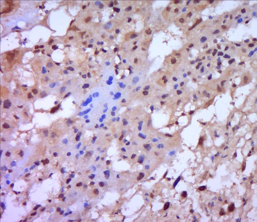 Anti-MMP-2 Polyclonal Antibody