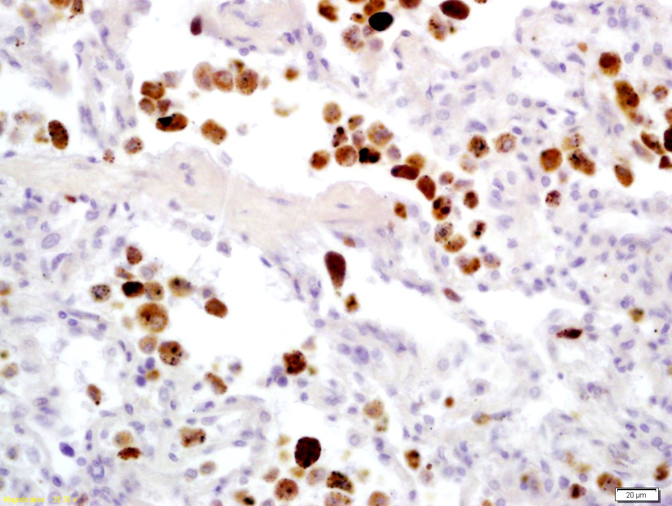 Anti-Granzyme B Polyclonal Antibody