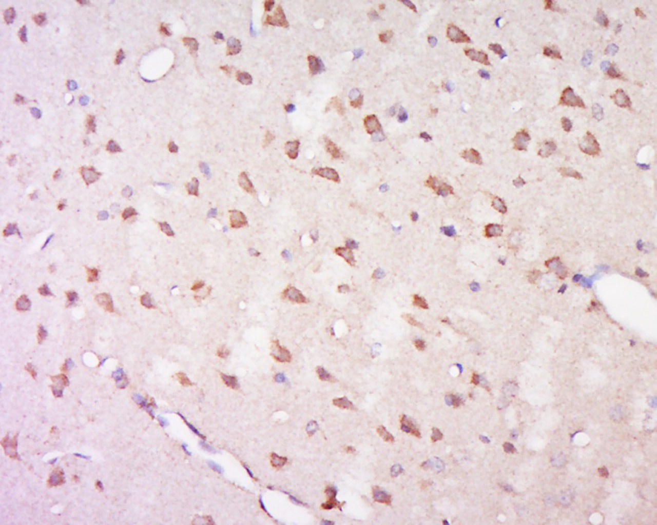 Anti-GPR92 Polyclonal Antibody