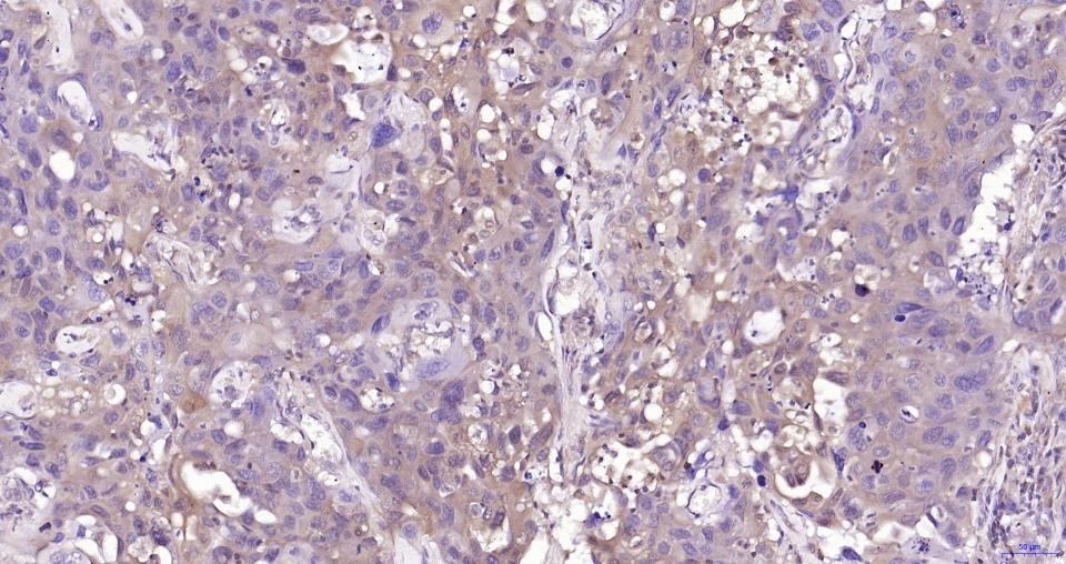 Anti-GPX4 Antibody (1B328)