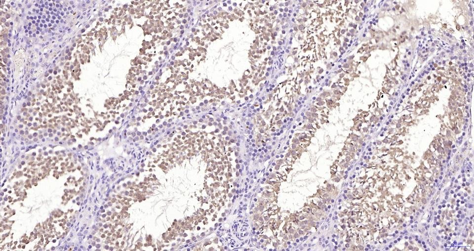 Anti-GPX4 Antibody (1B328)