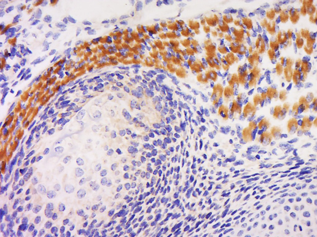 Anti-Gremlin-1 Polyclonal Antibody