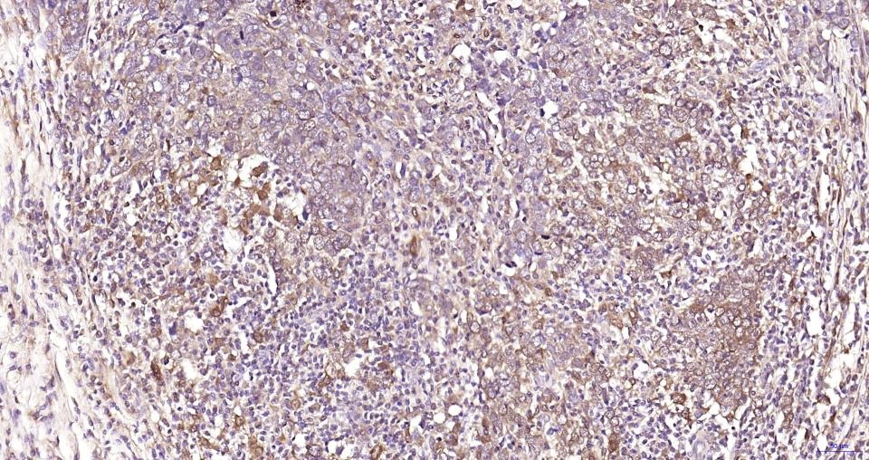 Anti-GPX4 Antibody (1B328)