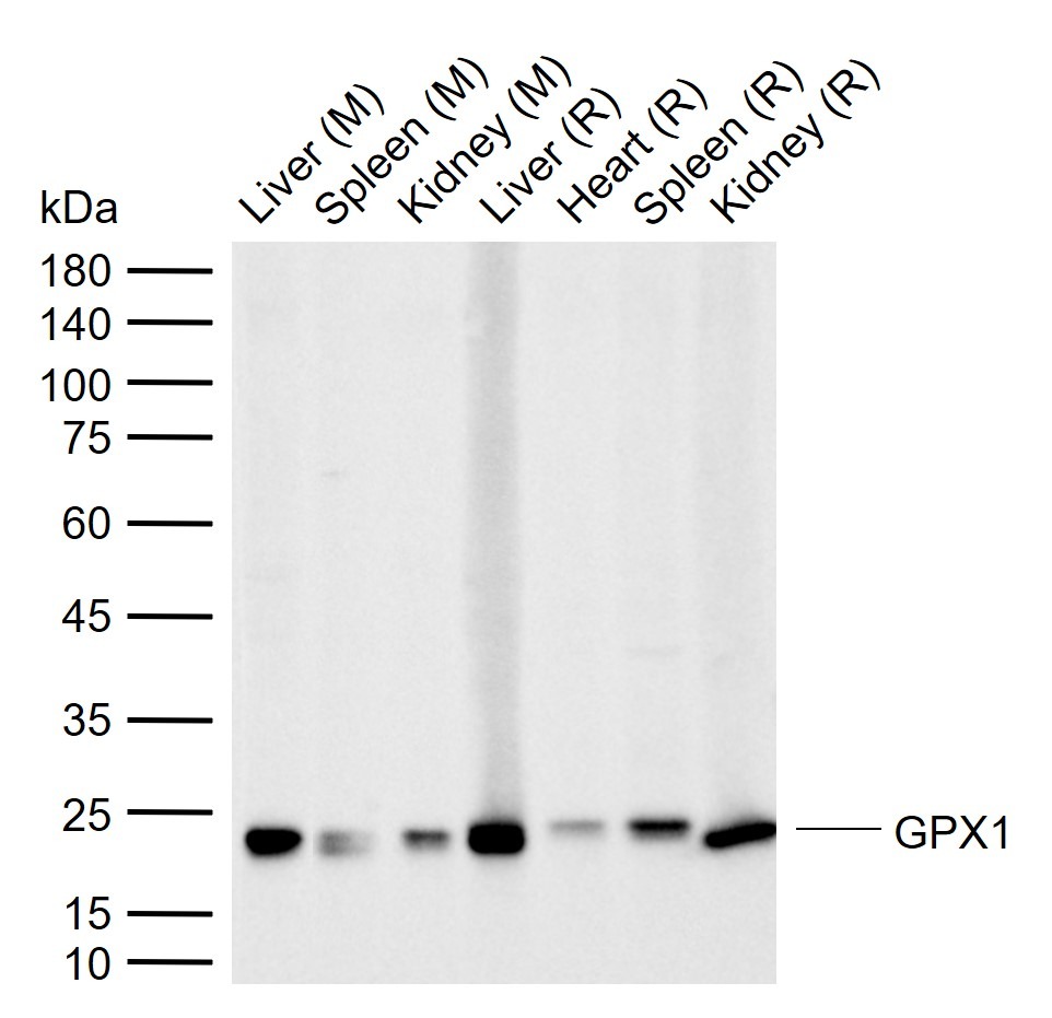Anti-GPX1 Polyclonal Antibody