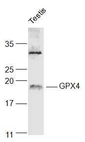 Anti-GPX4 Polyclonal Antibody