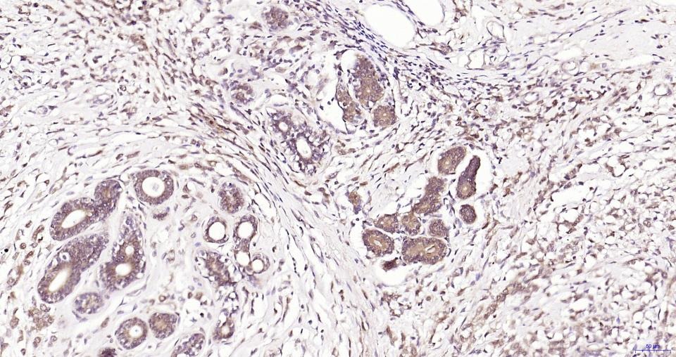 Anti-GPX4 Antibody (1B328)