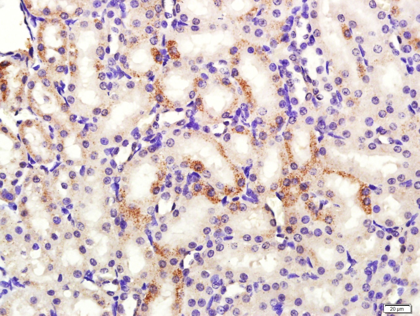 Anti-HSD3B1 Polyclonal Antibody
