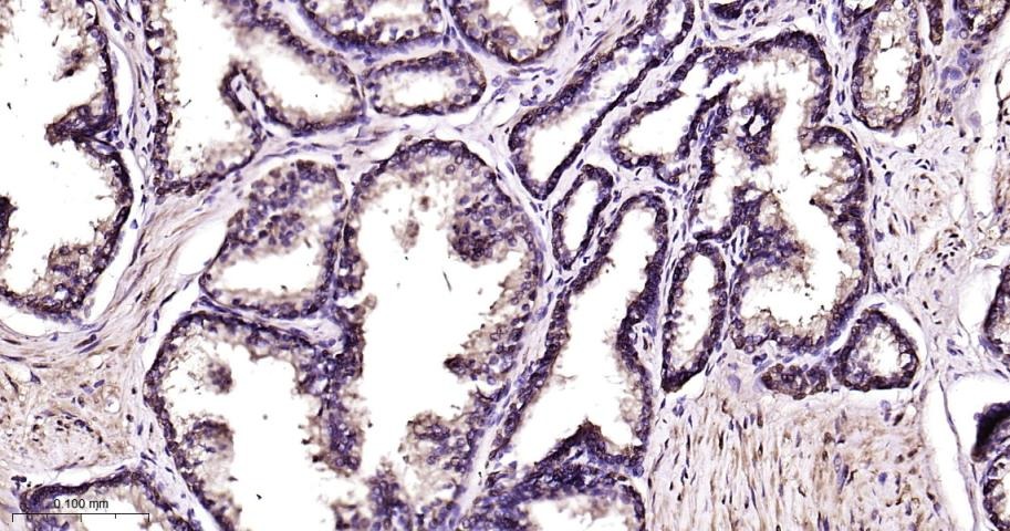 Anti-HSP70 Antibody (9K165)
