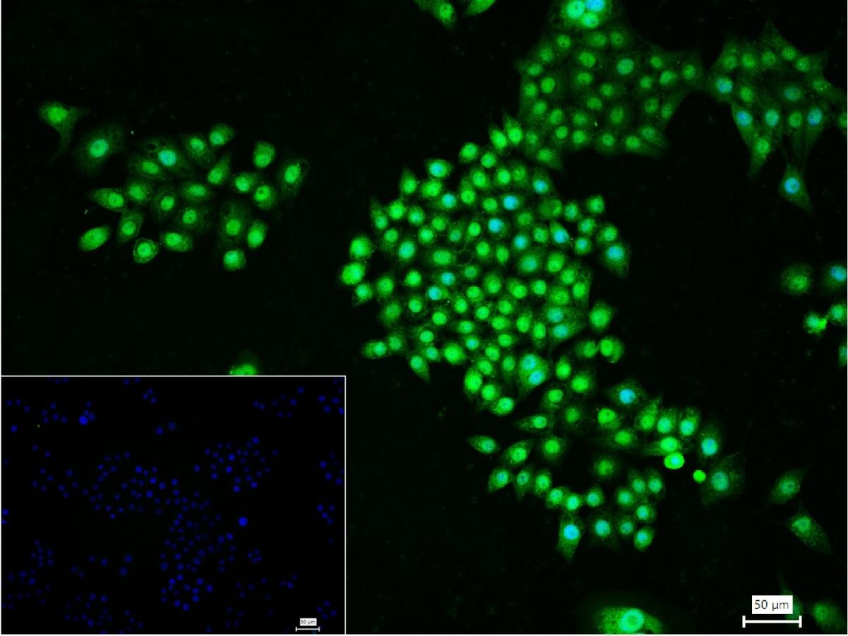 Anti-HSP70 Antibody (9K165)