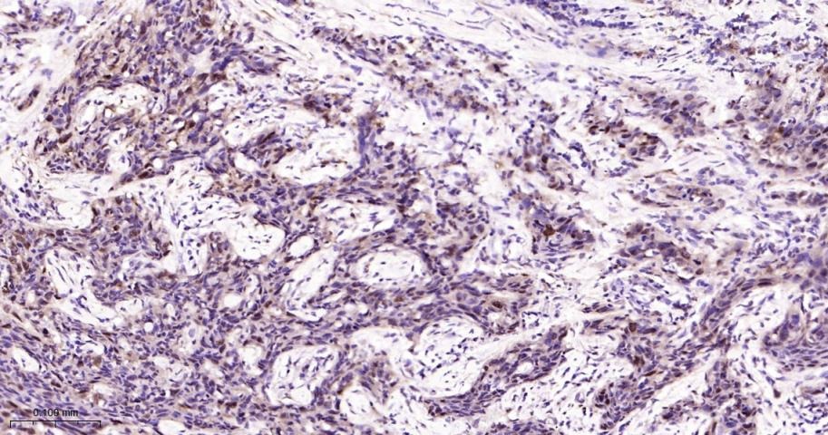 Anti-HSP70 Antibody (9K165)