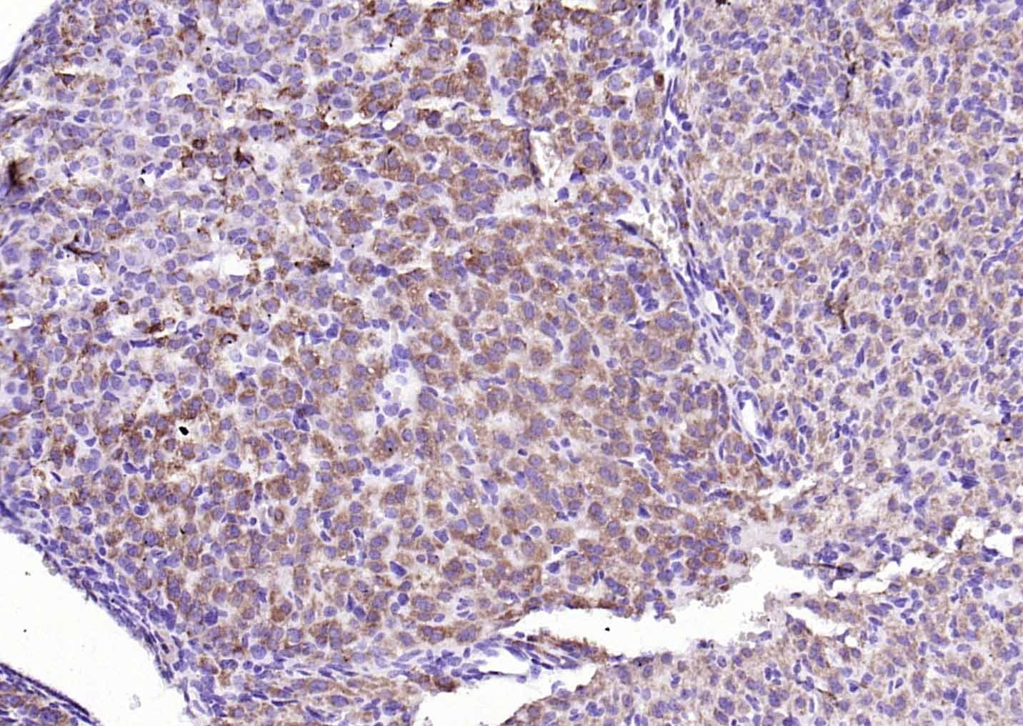 Anti-HSD3B1 Polyclonal Antibody