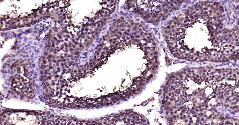 Anti-HSP70 Antibody (9K165)