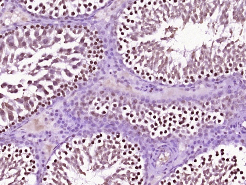 Anti-HSP70 Polyclonal Antibody 2