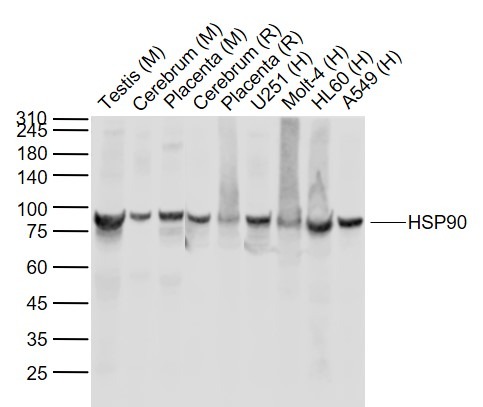 Anti-HSP90AA1 Antibody (5N776)