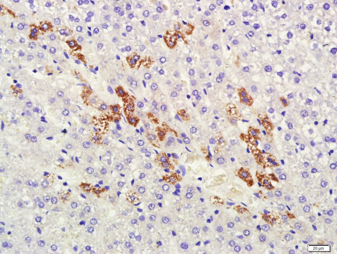 Anti-HSD3B1 Polyclonal Antibody