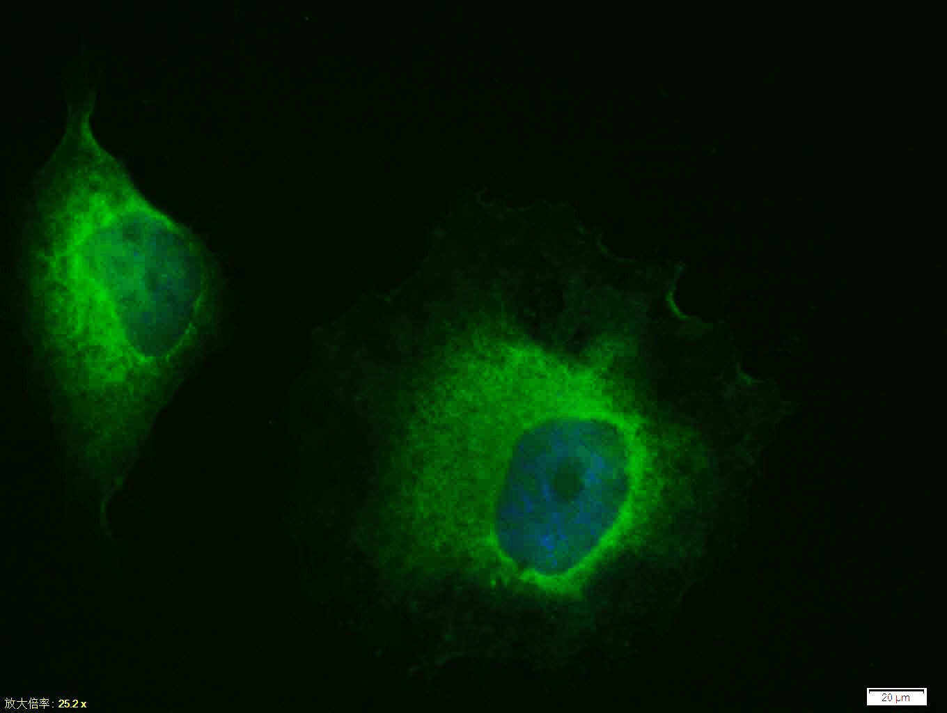 Anti-HSP70 Polyclonal Antibody