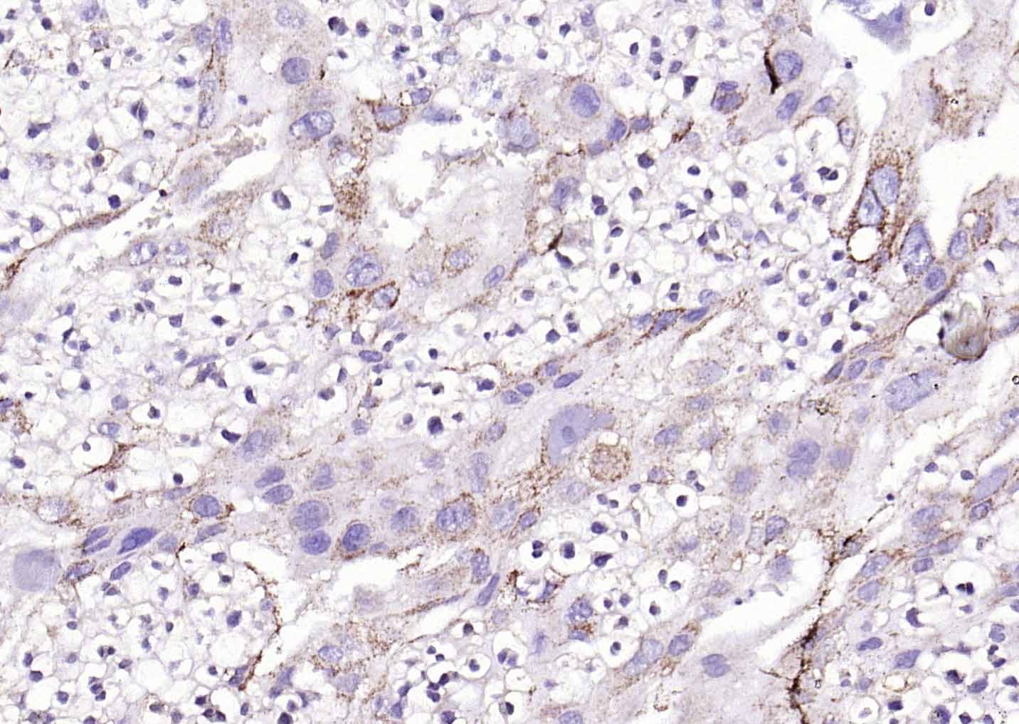 Anti-HSD3B1 Polyclonal Antibody