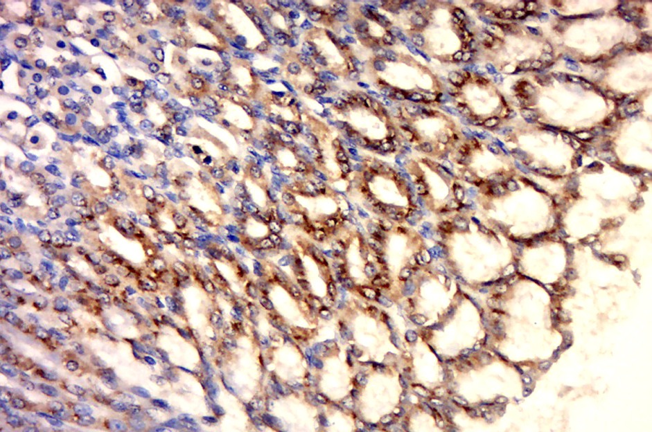 Anti-HSP60 Polyclonal Antibody