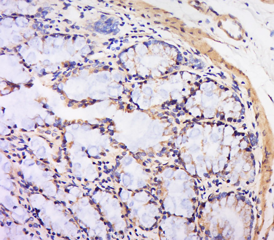 Anti-Gremlin-1 Polyclonal Antibody