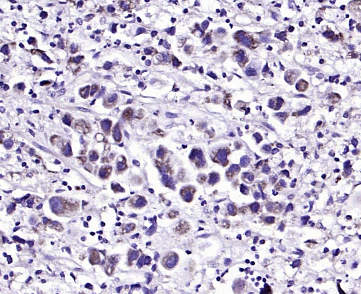 Anti-Gremlin-1 Polyclonal Antibody