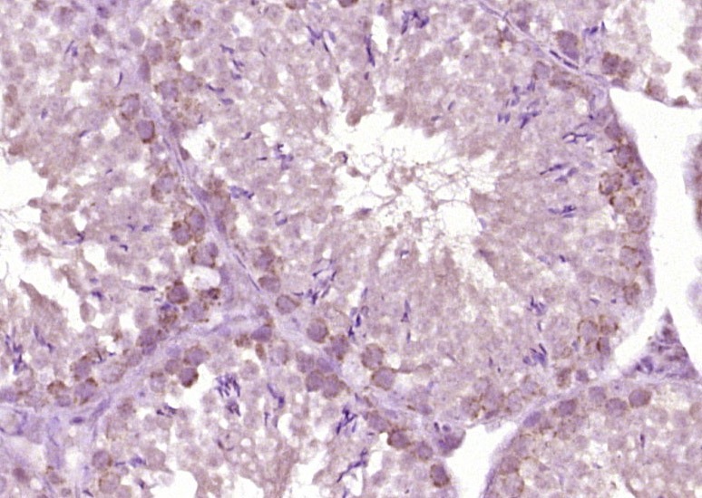 Anti-HSD17B3 Polyclonal Antibody