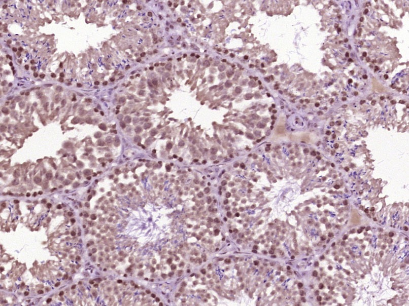 Anti-HSP70 Polyclonal Antibody 2