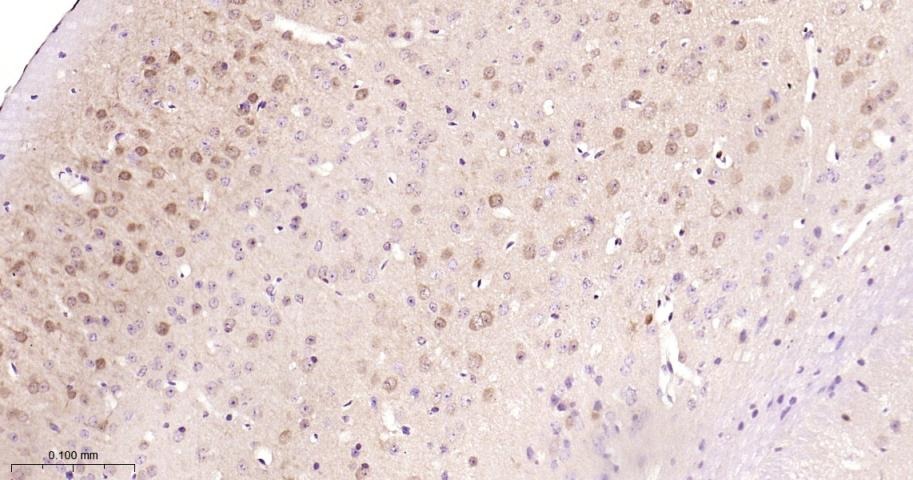 Anti-HSP70 Antibody (9K165)