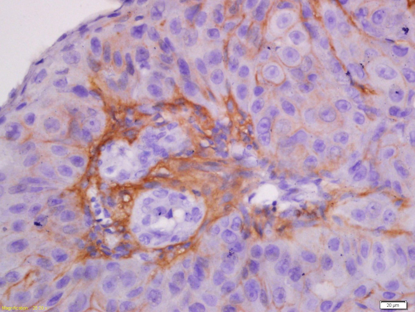 Anti-KRT7 Polyclonal Antibody