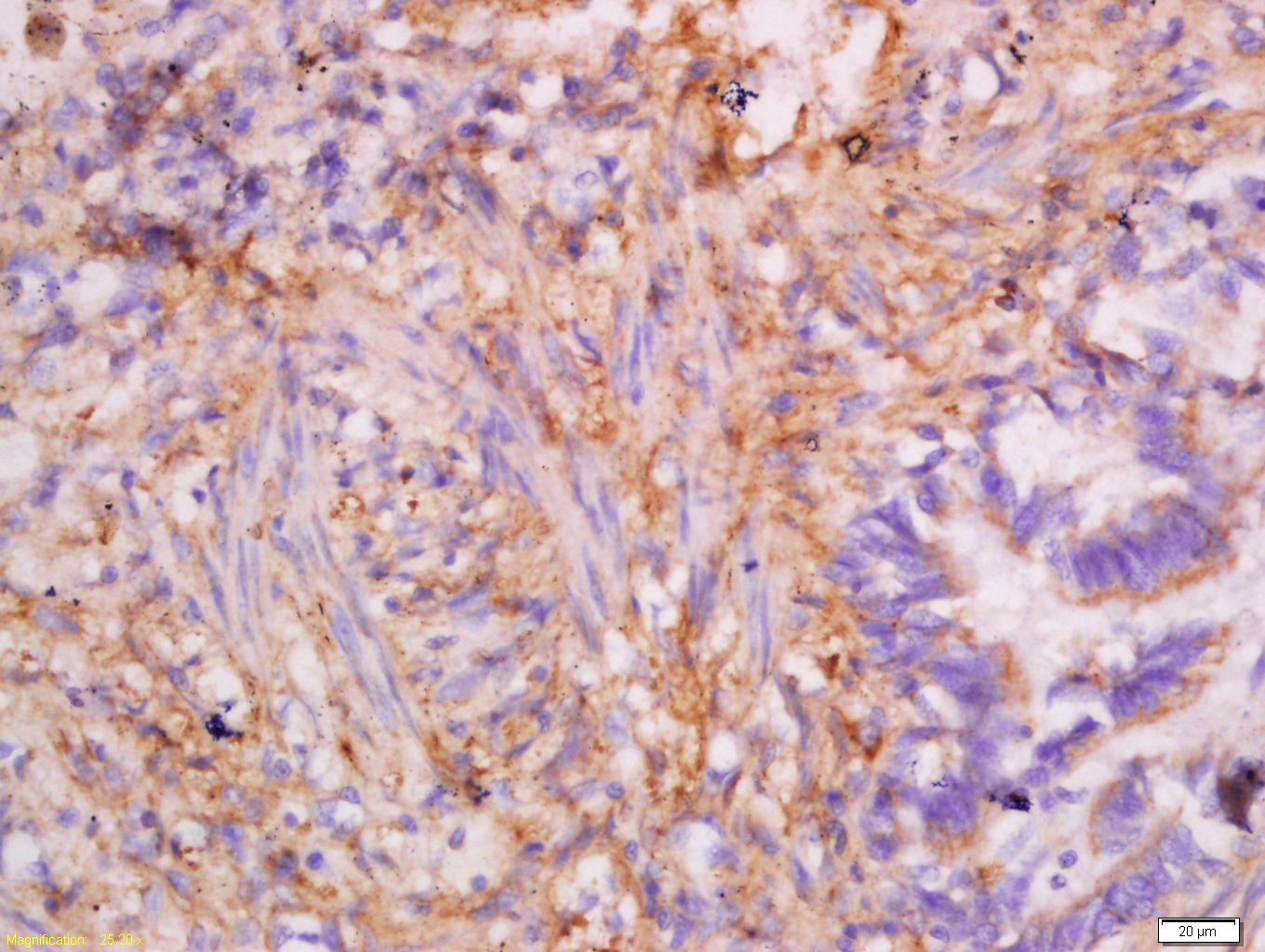 Anti-KRT7 Polyclonal Antibody