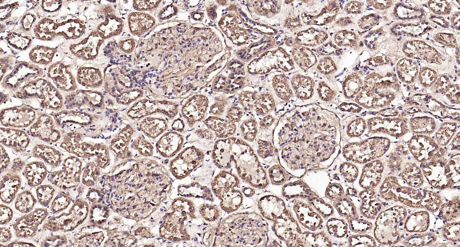 Anti-LAMP1 Polyclonal Antibody