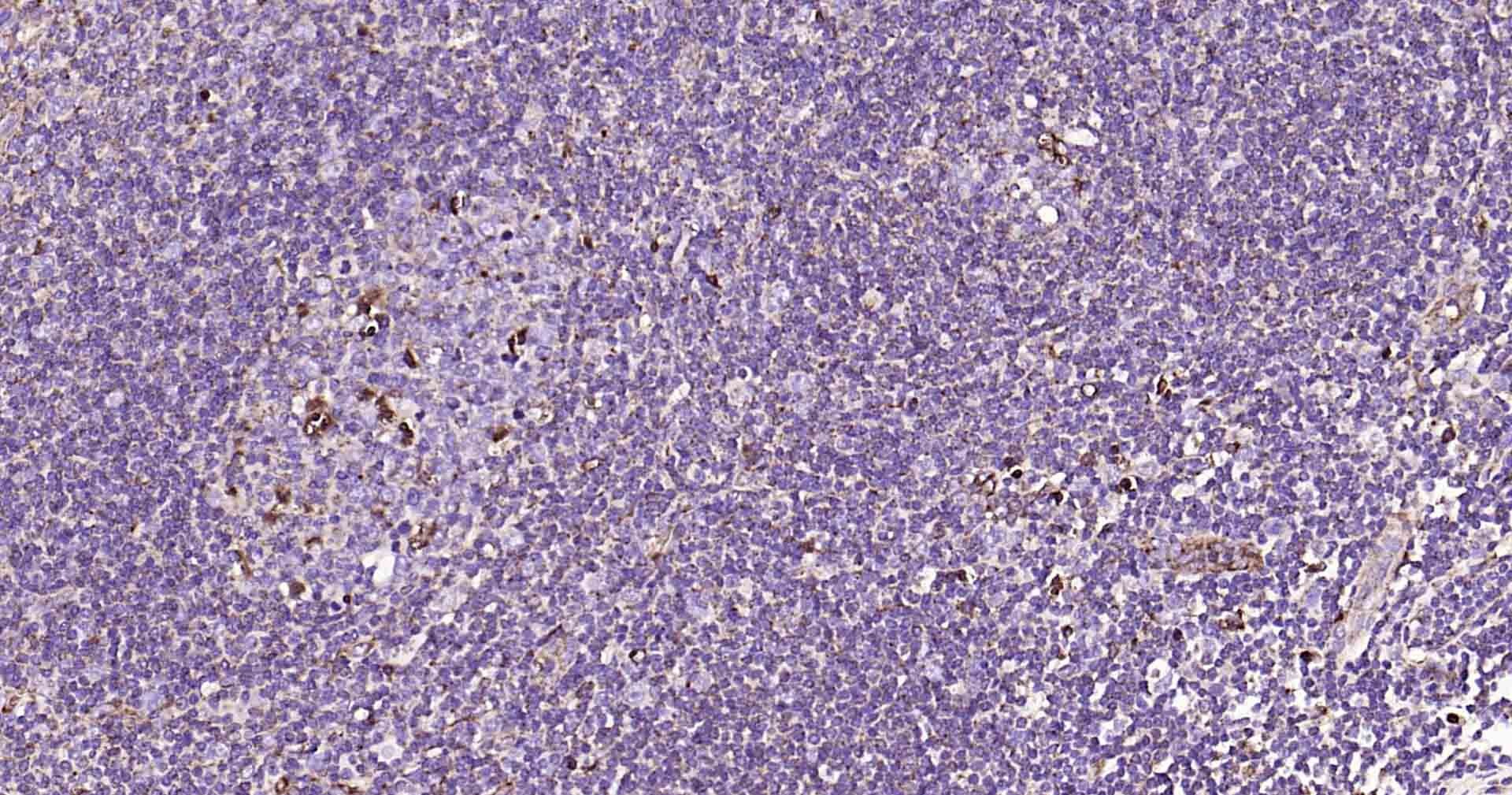 Anti-LAMP1 Polyclonal Antibody