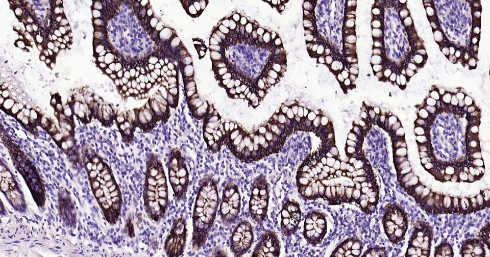 Anti-KRT20 Antibody (9H184)