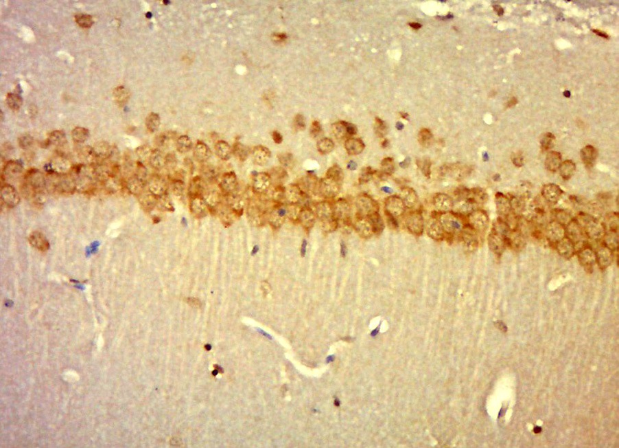 Anti-Laminin subunit beta-1 Polyclonal Antibody