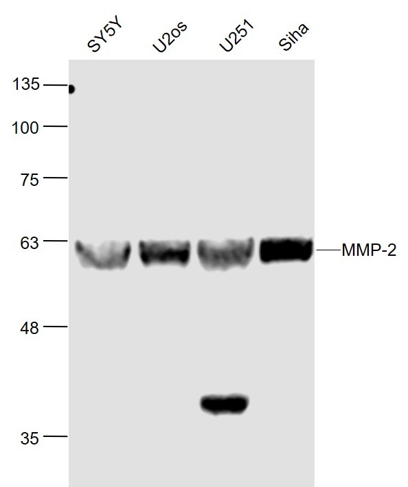 Anti-MMP-2 Polyclonal Antibody 3