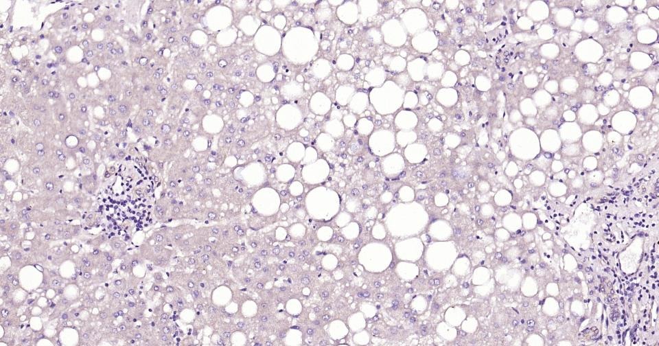Anti-KRT20 Antibody (9H184)