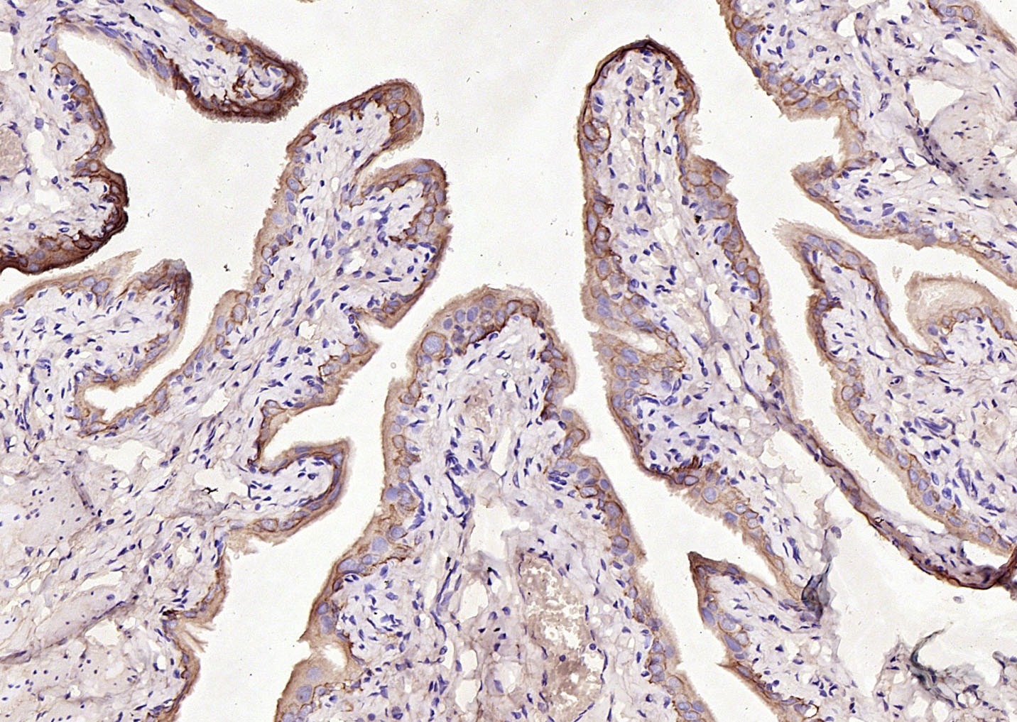 Anti-KRT7 Polyclonal Antibody