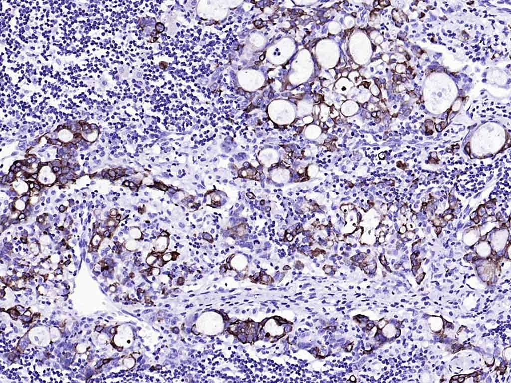 Anti-KRT20 Antibody (9H184)