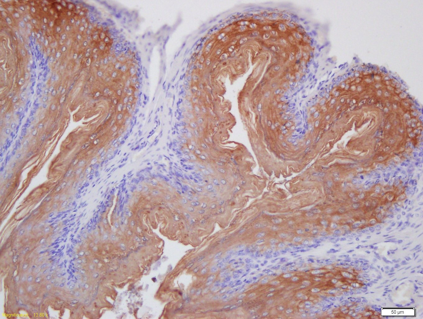 Anti-Laminin 5 Polyclonal Antibody