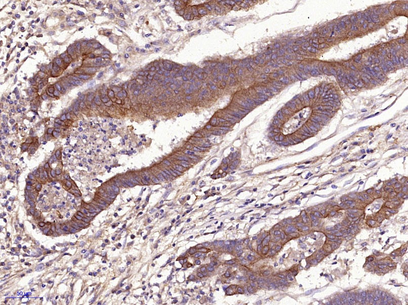 Anti-KRT19 Polyclonal Antibody