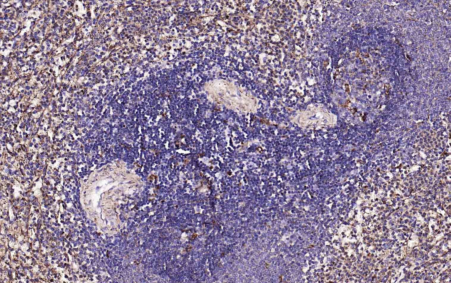 Anti-LAMP1 Polyclonal Antibody