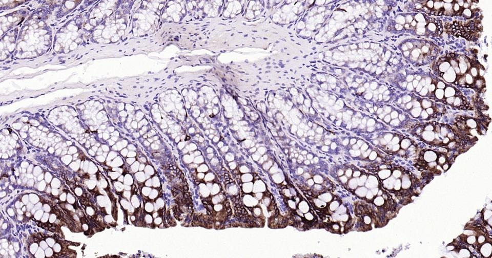 Anti-KRT20 Antibody (9H184)