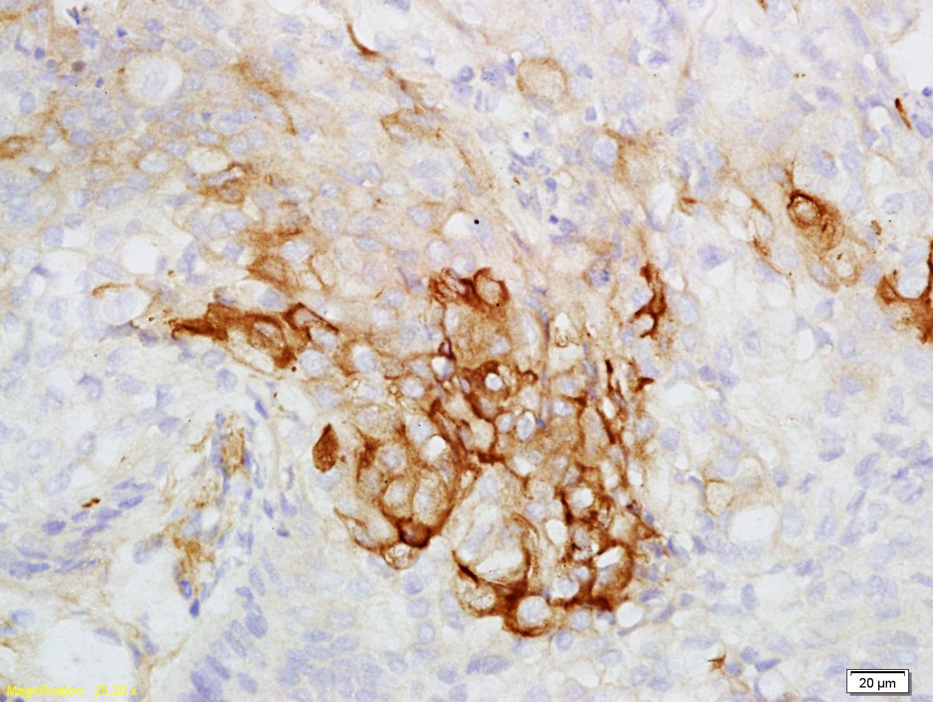 Anti-KRT7 Polyclonal Antibody