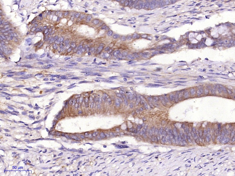 Anti-KRT19 Polyclonal Antibody