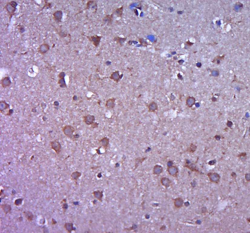 Anti-MMP-2 Polyclonal Antibody 3