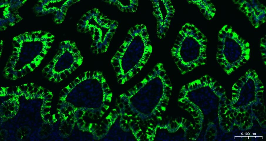 Anti-KRT20 Antibody (9H184)