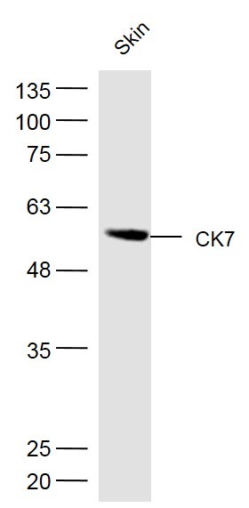 Anti-KRT7 Polyclonal Antibody