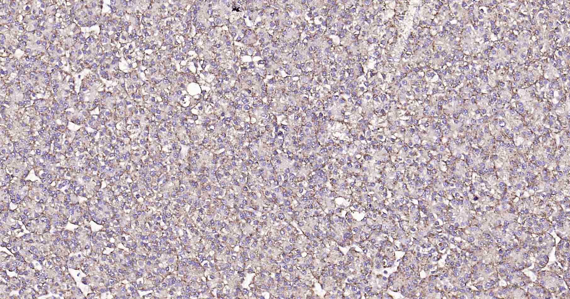 Anti-LAMP1 Polyclonal Antibody